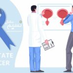 پروستات