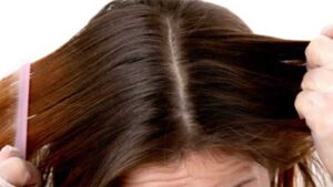 دیتاکس درمانی مو چیست؟