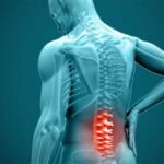 دیسک کمر چگونه است؟