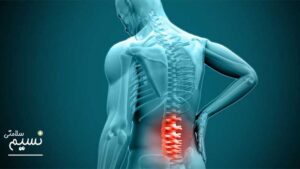 دیسک کمر چگونه است؟