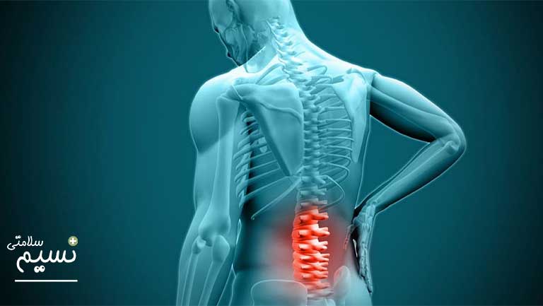 دیسک کمر چگونه است؟